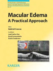 Macular Edema: A Practical Approach